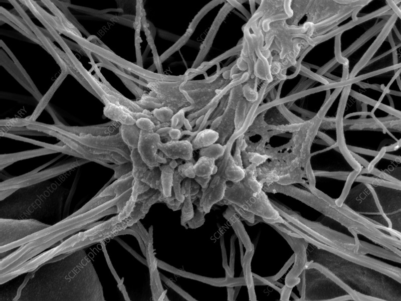 SEM Microscopy: Hexagonal Platelets